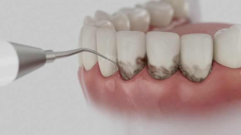 Trusted Teeth Cleaning And Checkup service in Bon Secour, AL - Dentist Open Now